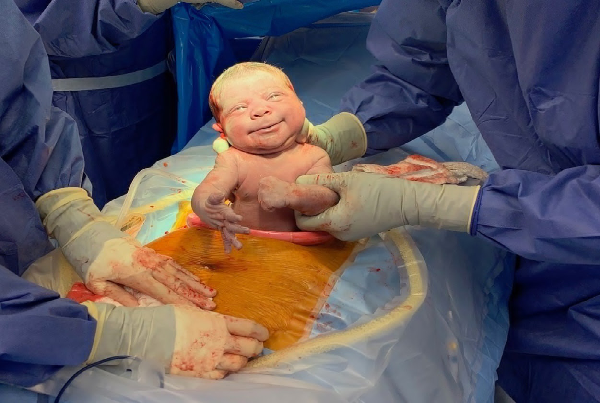 Normal and Cesarean Delivery