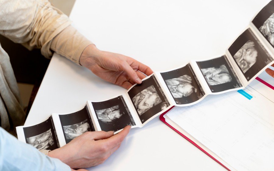 Gynecologist reviewing pregnancy ultrasound images during a consultation
