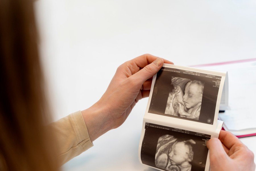 Pregnant woman viewing ultrasound images during pregnancy care