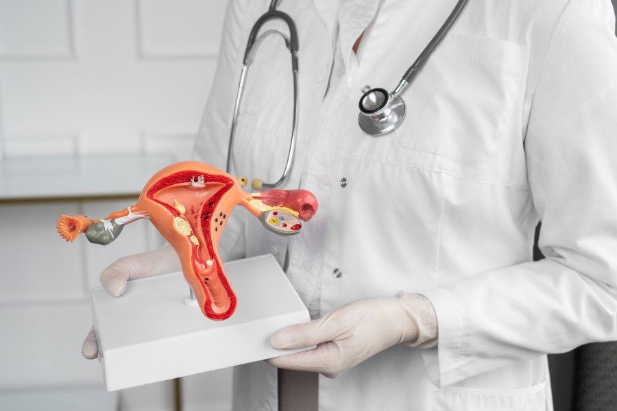 Doctor holding a detailed anatomical model of the female reproductive system.