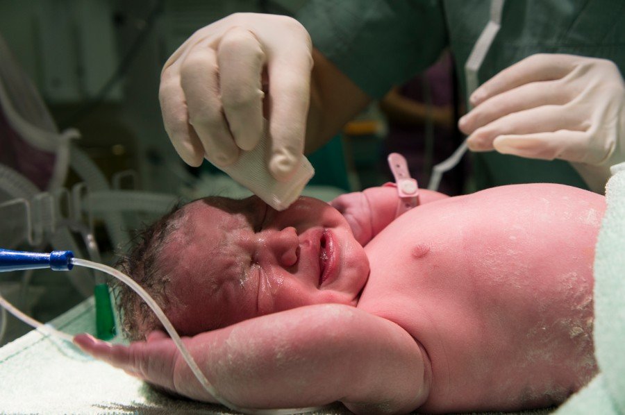 Normal Delivery of a newborn baby, with medical staff gently cleaning the baby immediately after birth